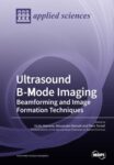 Ultrasound B-Mode Imaging: Beamforming and Image Formation Techniques